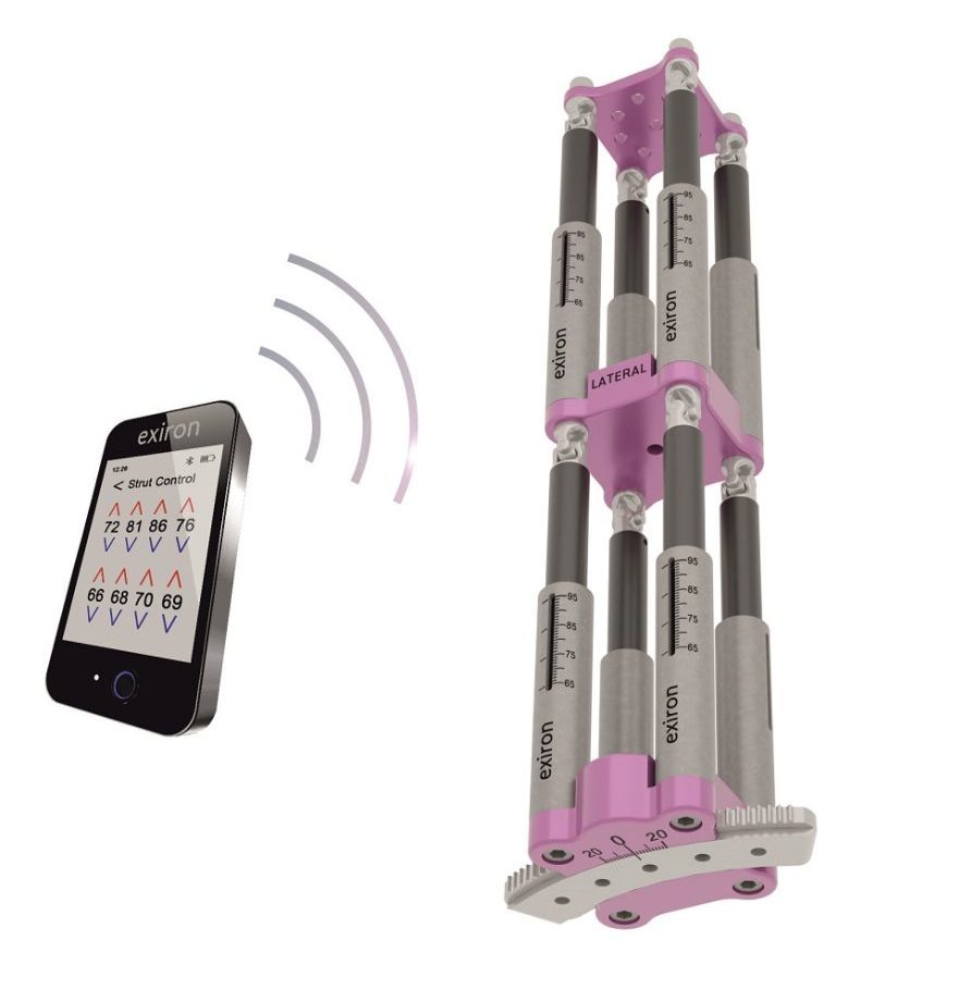 Exiron Robotic Fixator